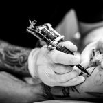 tatuaż - usuwanie 